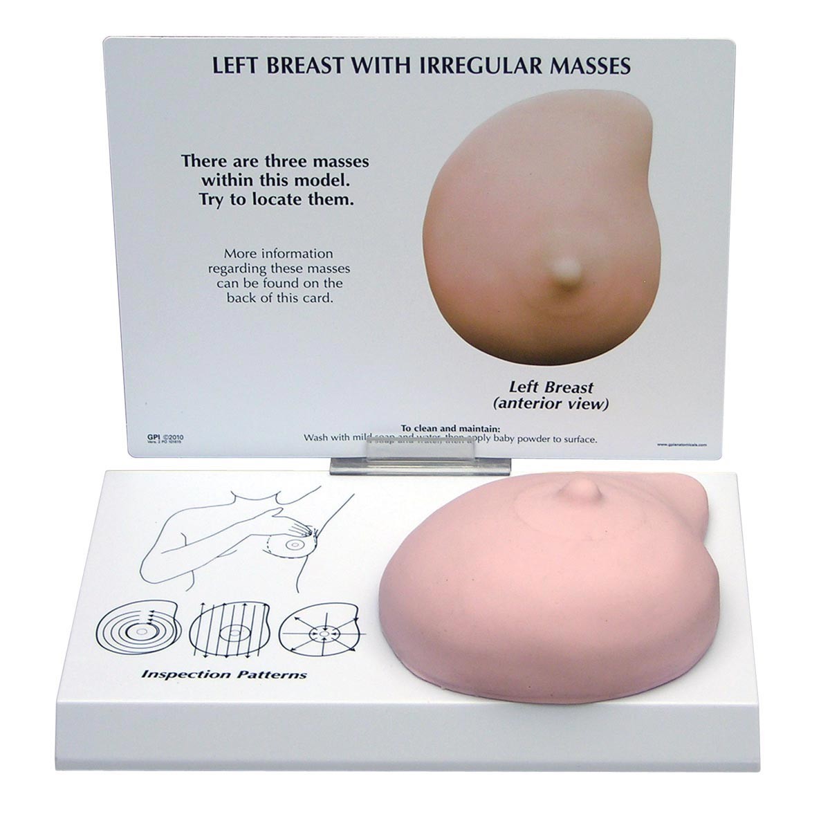 Modell einer linken Brust mit unregelmäßigen Massen