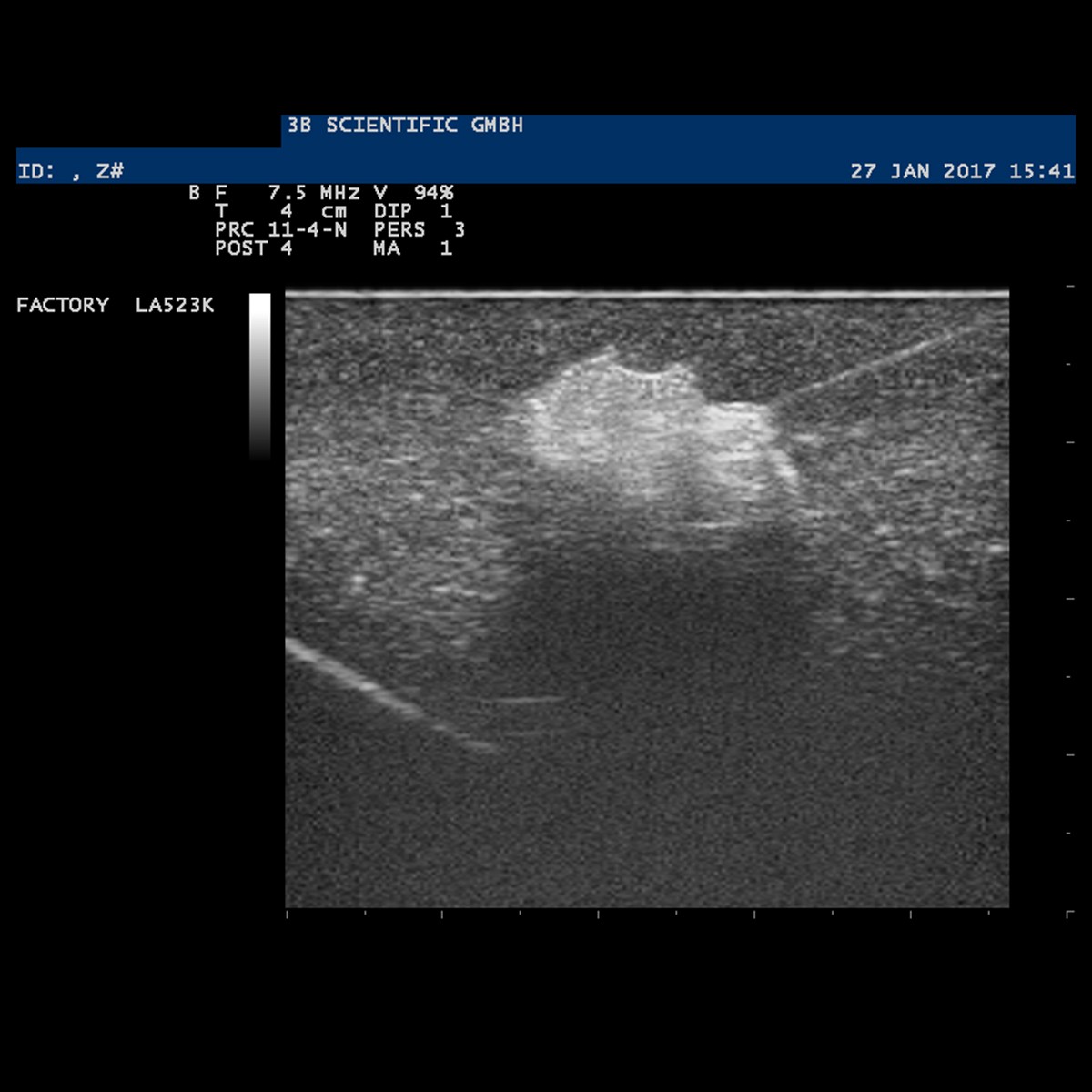 SONOtrain™ Ultraschall Brustmodell mit Tumoren