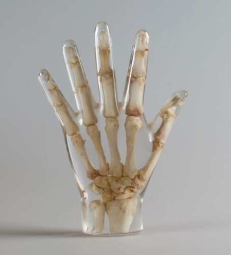 Röntgenphantom Hand, transparent
