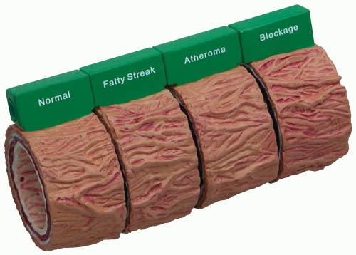 Arterienmodell, 4-teilig