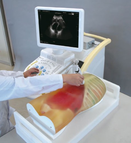 FAST-Ultraschall-Untersuchungsmodell