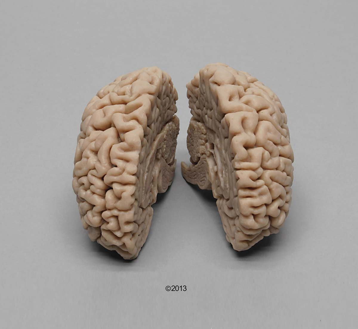 Menschliches Gehirn, Naturabguss 1