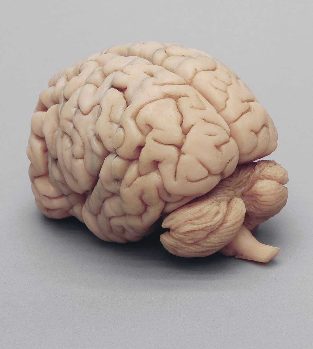 Menschliches Gehirn in Frontalschnitten 1