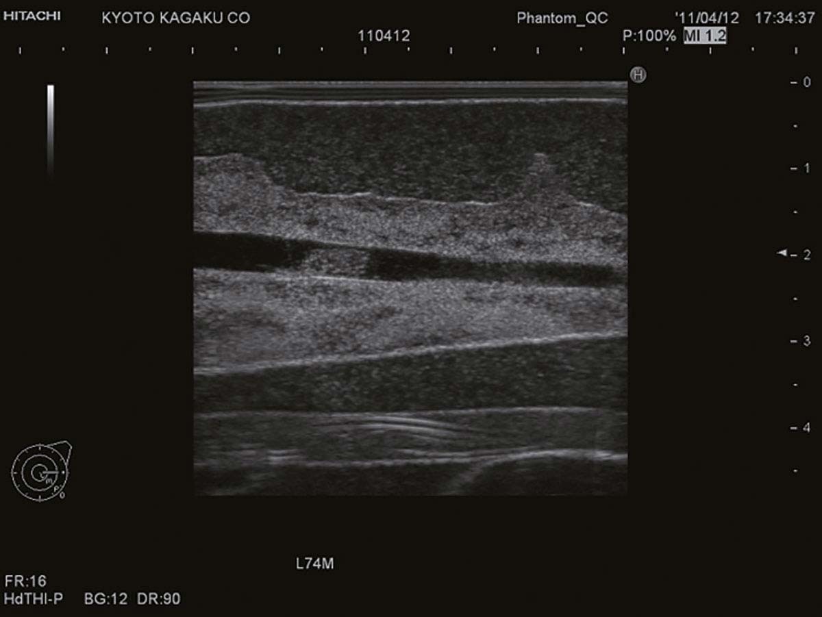 Ultraschalluntersuchungsphantom-Brust 1