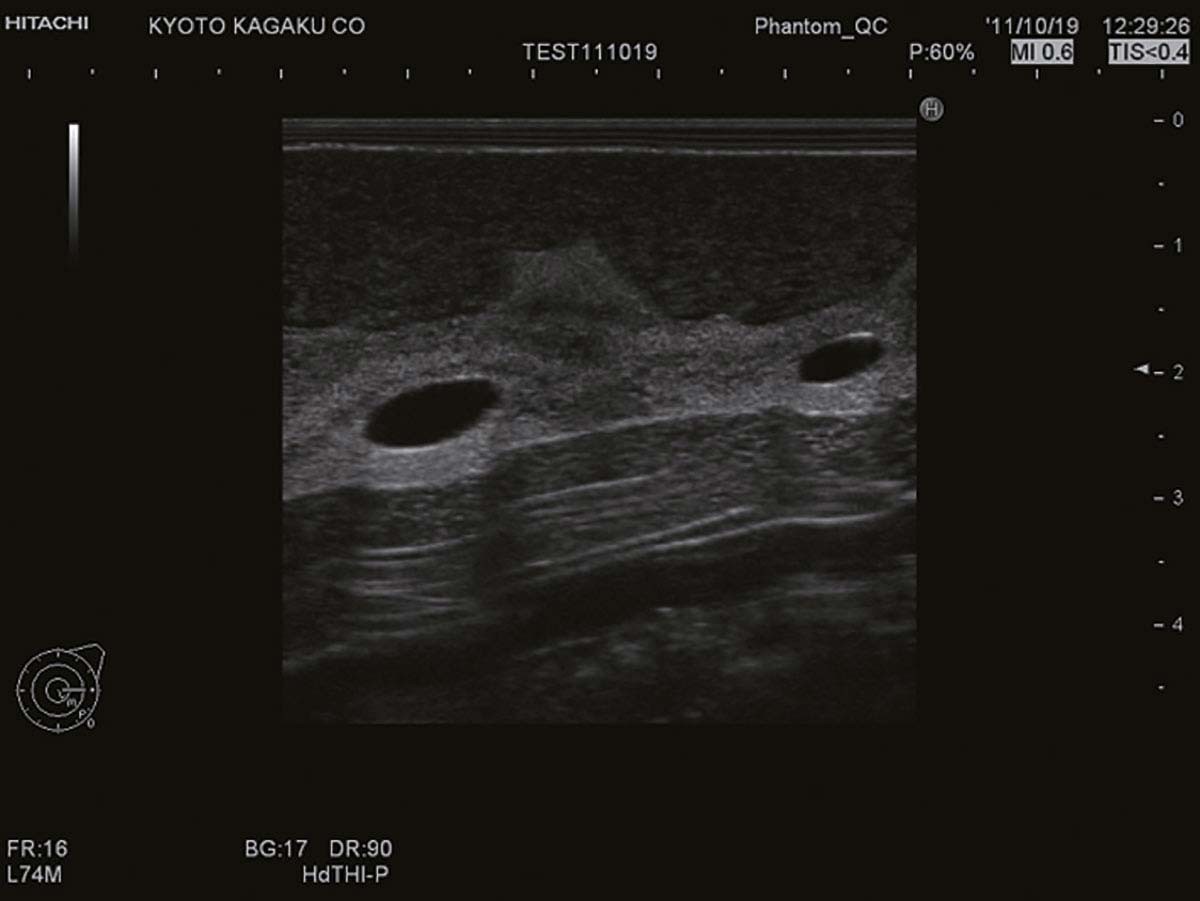 Ultraschalluntersuchungsphantom-Brust 1
