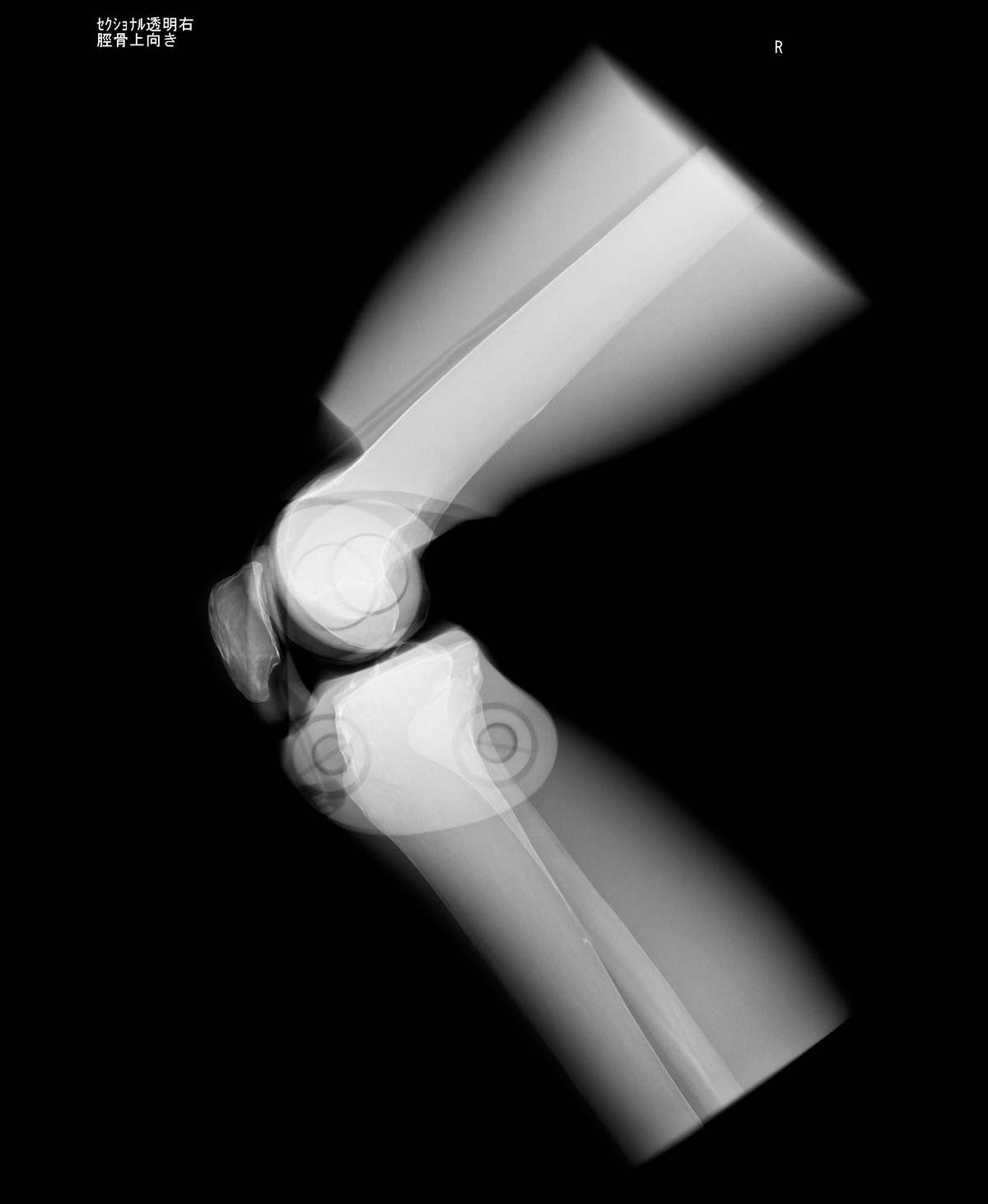 Röntgen-Teilphantom mit künstlichen Knochen - Rechtes Knie, transparent 1