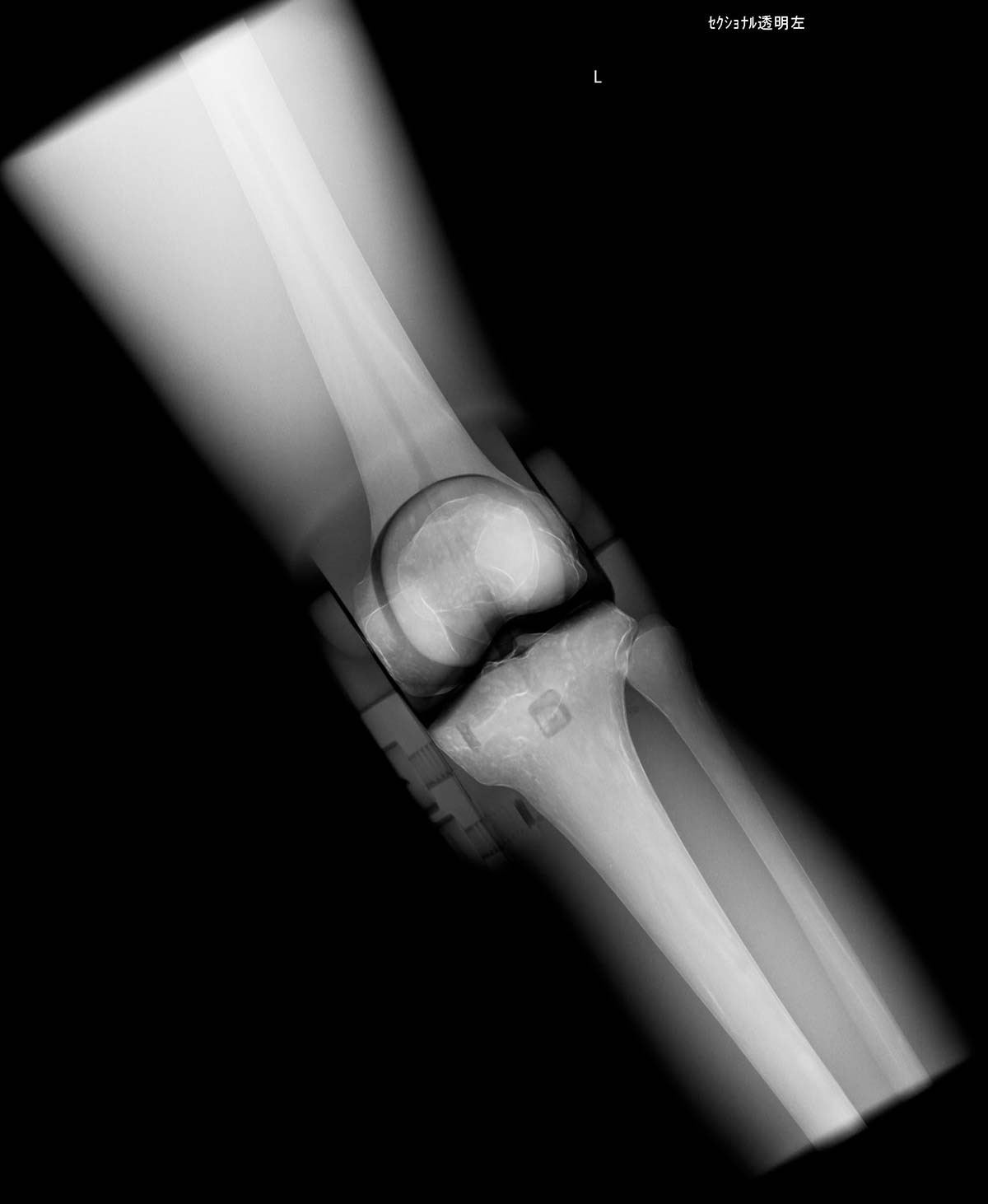 Röntgen-Teilphantom mit künstlichen Knochen - Rechtes Knie, transparent 1