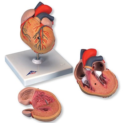 Klassik-Herz mit linksventrikulärer Hypertrophie (LVH), 2-teilig