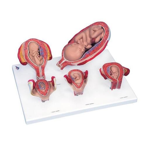 3B Scientific® Schwangerschaftsserie, 5 Modelle