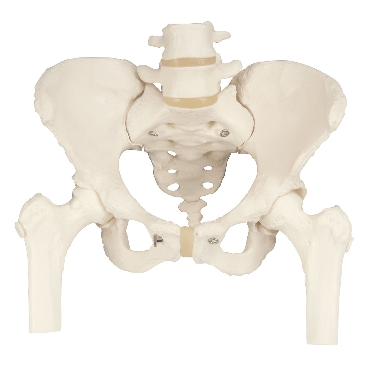Becken-Skelett, weiblich, mit Oberschenkelstümpfen