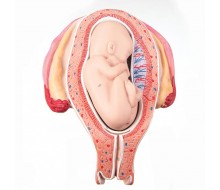 Fetus, 5. Monat, Steißlage