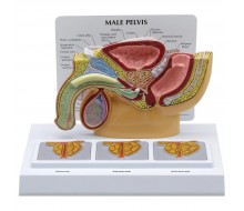 Männliches Becken mit 3D-Prostata-Rahmen