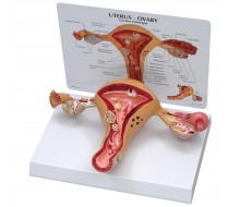 Gebärmutter Eierstockmodell