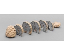 Menschliches Gehirn in Frontalschnitten 1