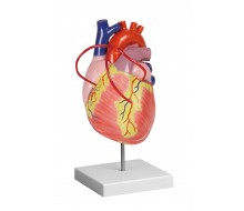 Herz mit Bypass, 2-fache Lebensgröße, 2 Teile 1