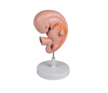 Menschlicher Embryo, 4 Wochen 1