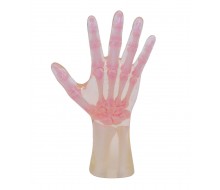 Röntgen-Teilphantom mit künstlichen Knochen - Rechte Hand, transparent 1