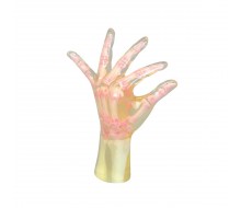 Röntgen-Teilphantom mit künstlichen Knochen - Linke Hand, transparent 1
