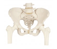 Becken-Skelett, weiblich, mit Oberschenkelstümpfen