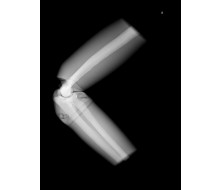Röntgen-Teilphantom mit künstlichen Knochen - Rechter Ellenbogen, opak 1