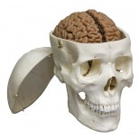 Menschliches Gehirn, Naturabguss 2