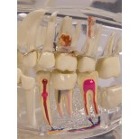 Transparenter menschlicher Kiefer mit Zähnen 2