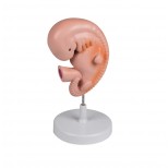 Menschlicher Embryo, 4 Wochen 1