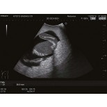 Ultraschalluntersuchungsphantom-Fötus 8