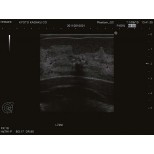 Ultraschalluntersuchungsphantom-Brust 3