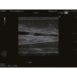 Ultraschalluntersuchungsphantom-Brust 4