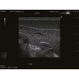 Ultraschalluntersuchungsphantom-Brust 5