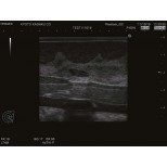 Ultraschalluntersuchungsphantom-Brust 6