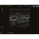 Ultraschalluntersuchungsphantom-Brust 7