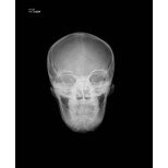 Röntgen-Teilphantom mit künstlichen Knochen - Kopfphantom, opak 3