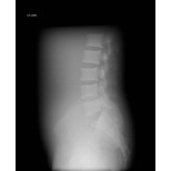 Röntgen-Teilphantom mit künstlichen Knochen - Becken, opak 3