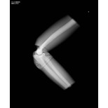 Röntgen-Teilphantom mit künstlichen Knochen - Rechter Ellenbogen, transparent 3