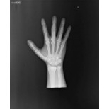 Röntgen-Teilphantom mit künstlichen Knochen - Rechte Hand, transparent 2