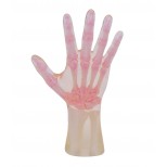 Röntgen-Teilphantom mit künstlichen Knochen - Rechte Hand, transparent 1