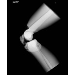 Röntgen-Teilphantom mit künstlichen Knochen - Rechtes Knie, transparent 3