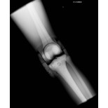 Röntgen-Teilphantom mit künstlichen Knochen - Rechtes Knie, transparent 4