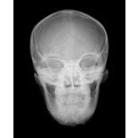 Röntgen-Teilphantom mit künstlichen Knochen - Kopfphantom, transparent 1