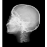 Röntgen-Teilphantom mit künstlichen Knochen - Kopfphantom, transparent 2